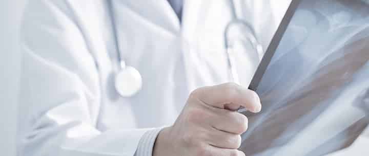 doctor looking at x-ray