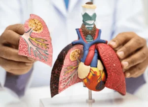 Clean medical graphic of lungs and pleura lining